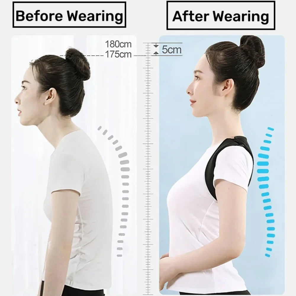 Stridewell Posture Corrector - Adjustable Back Support Brace